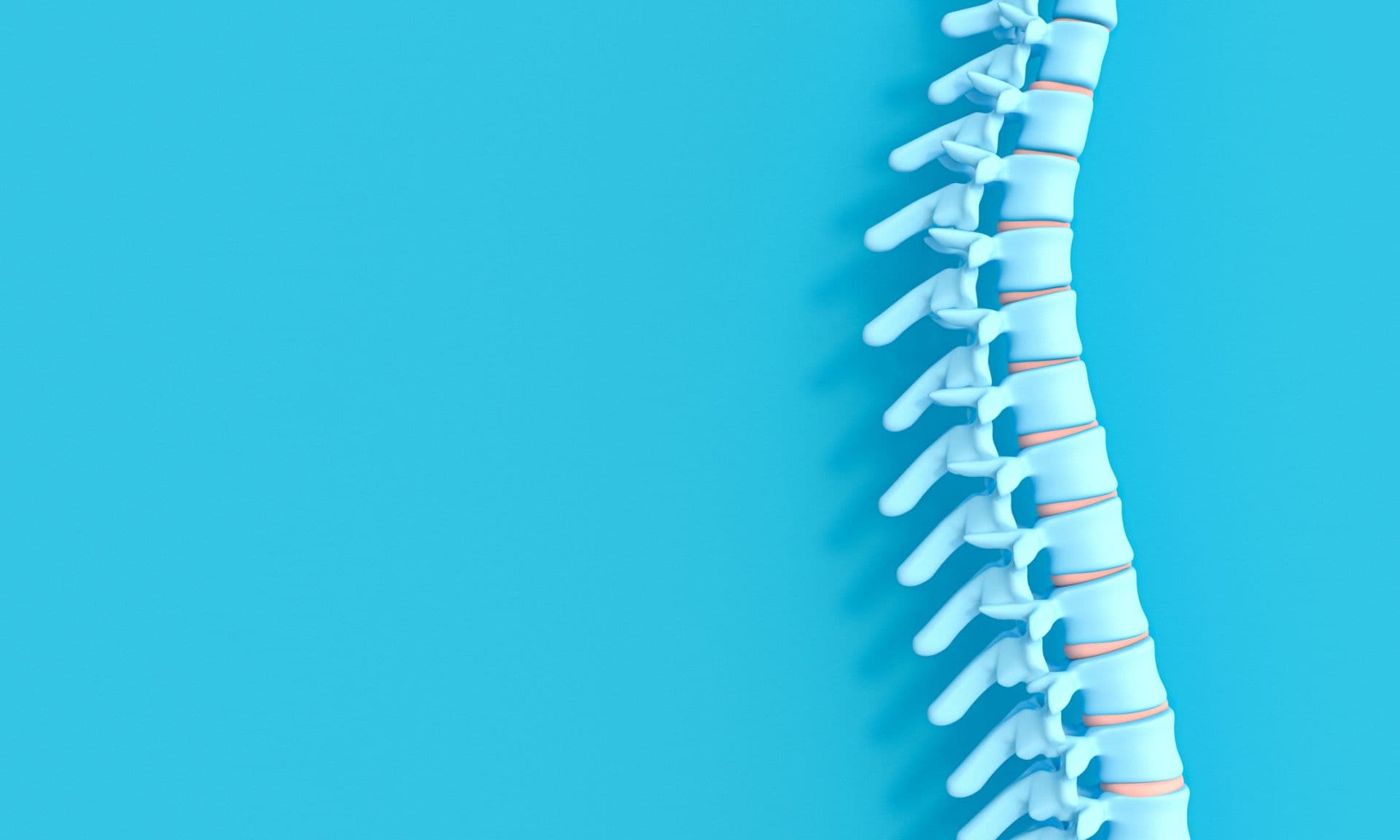 Die EULAR hat ihre Empfehlungen für die Behandlung der axialen Spondyloarthritis erneuert.