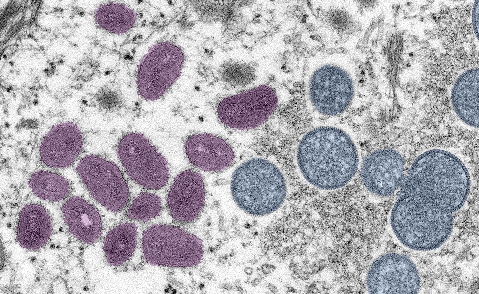 Die Mpox haben sich im letzten Jahr als STD einen Namen gemacht.