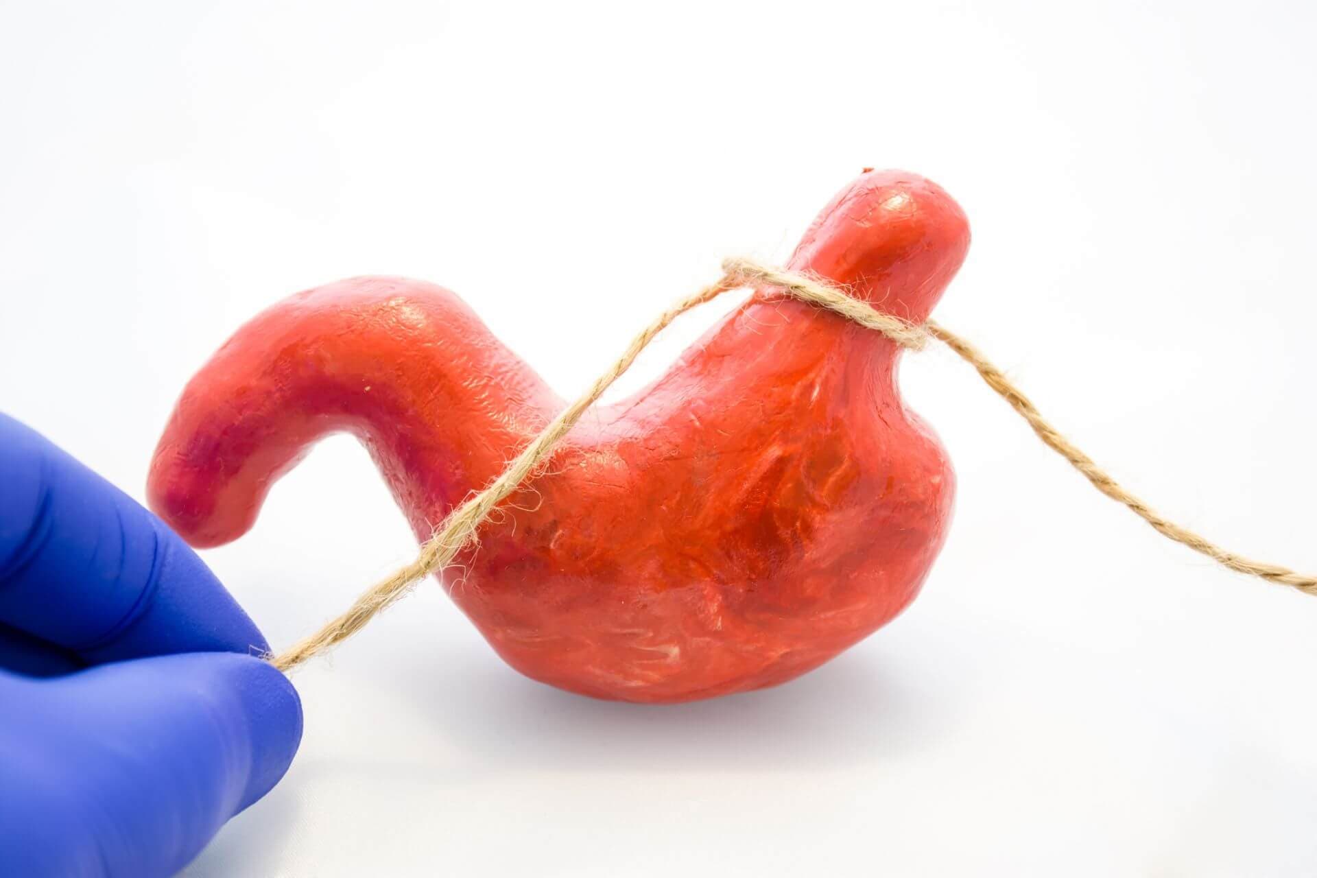 Endoskopische Verfahren sind zwar weniger effektiv als bariatrische chirurgische Eingriffe, verursachen aber auch weniger Komplikationen.