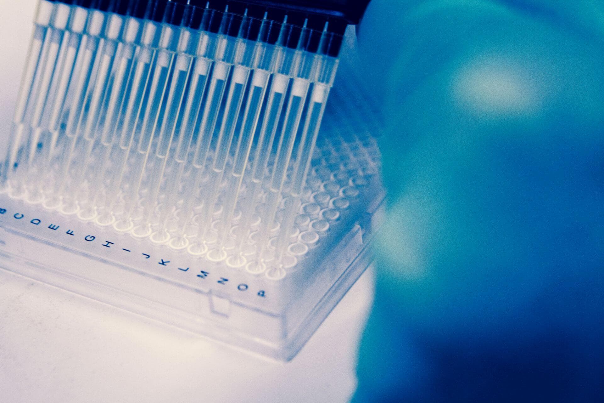 Omics-Daten könnten künftig helfen, zwischen Schlaganfällen und Stroke Mimics zu unterscheiden