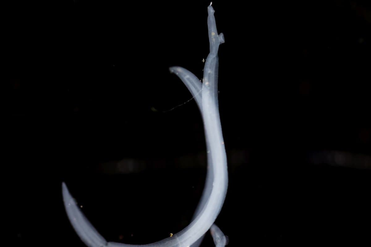 Zu den möglichen Parasiten in der Lunge zählen Schistosomen.