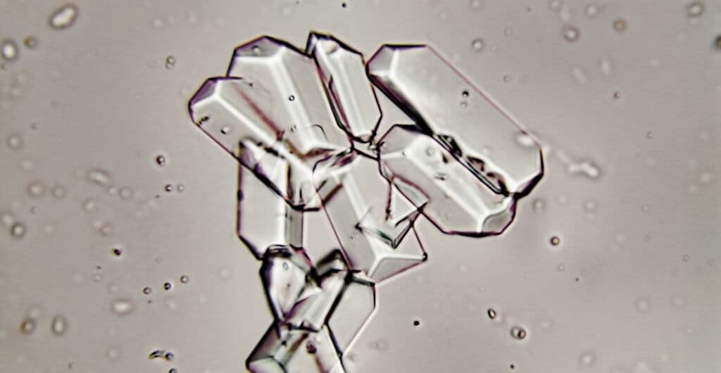 Die meisten Nierensteine bestehen aus Kalziumoxalat. Hydrochlorthiazid soll diese auflösen.