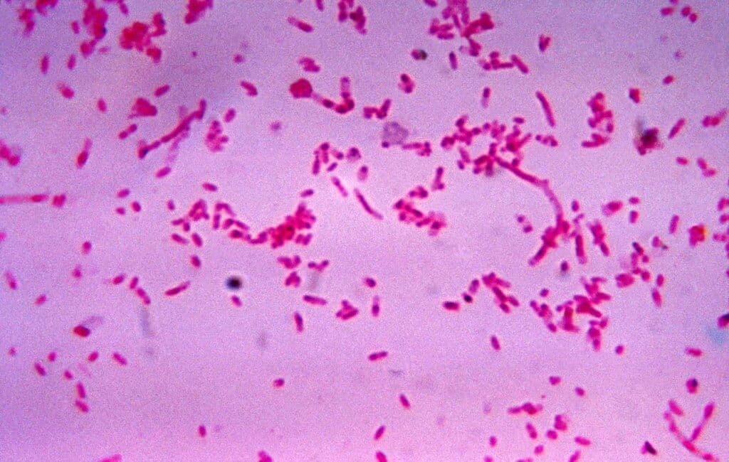 Fusobakterien könnten in die Entstehung der Endometriose involviert sein.