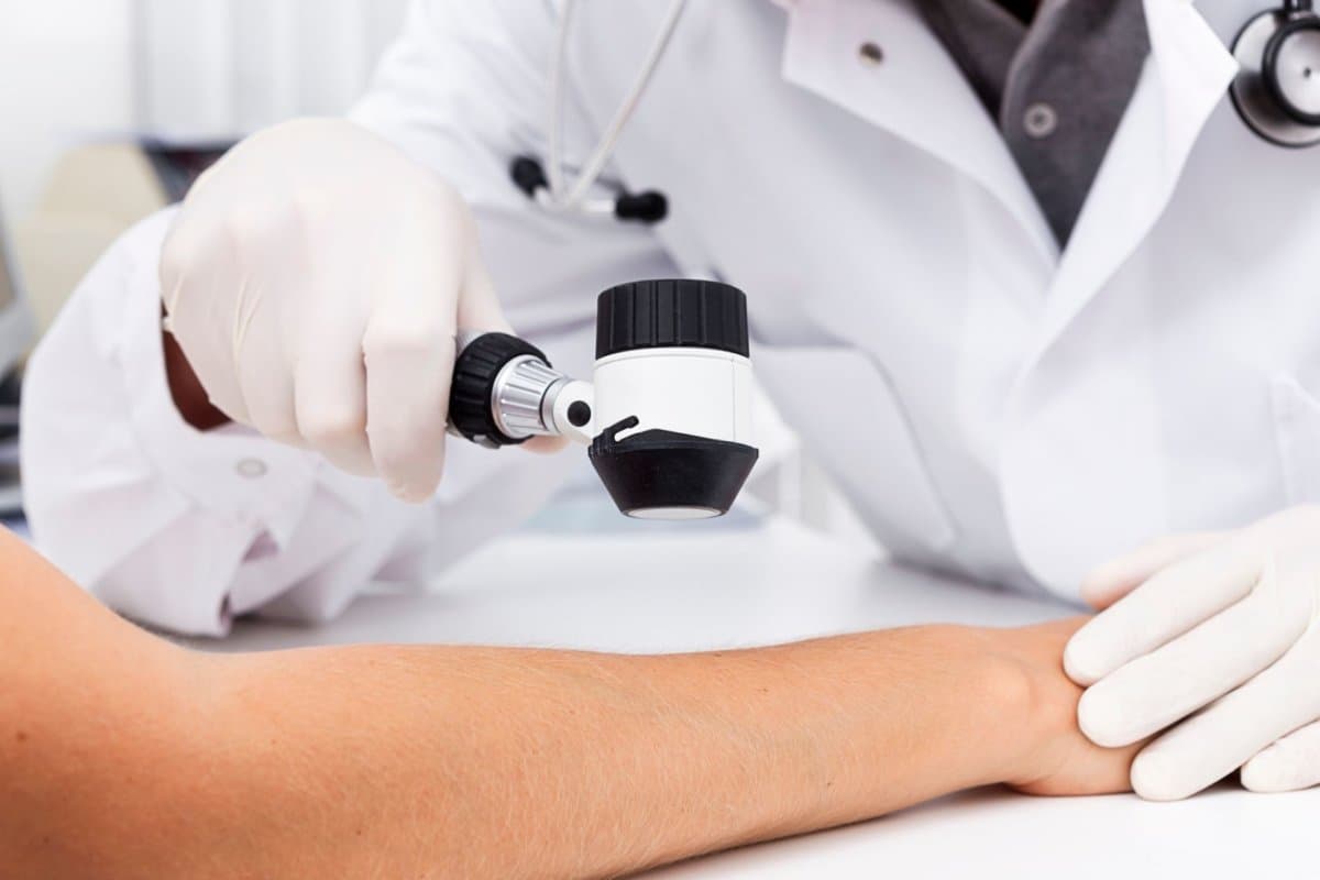 Unter Methotrexat-Behandlung sollten Patienten regelmässig auf Hautkrebs überprüft werden.