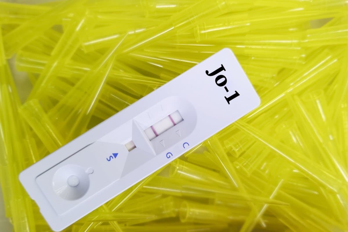 Zu einer Polymyositis oder Dermatomyositis gesellt sich nicht selten eine ILD.