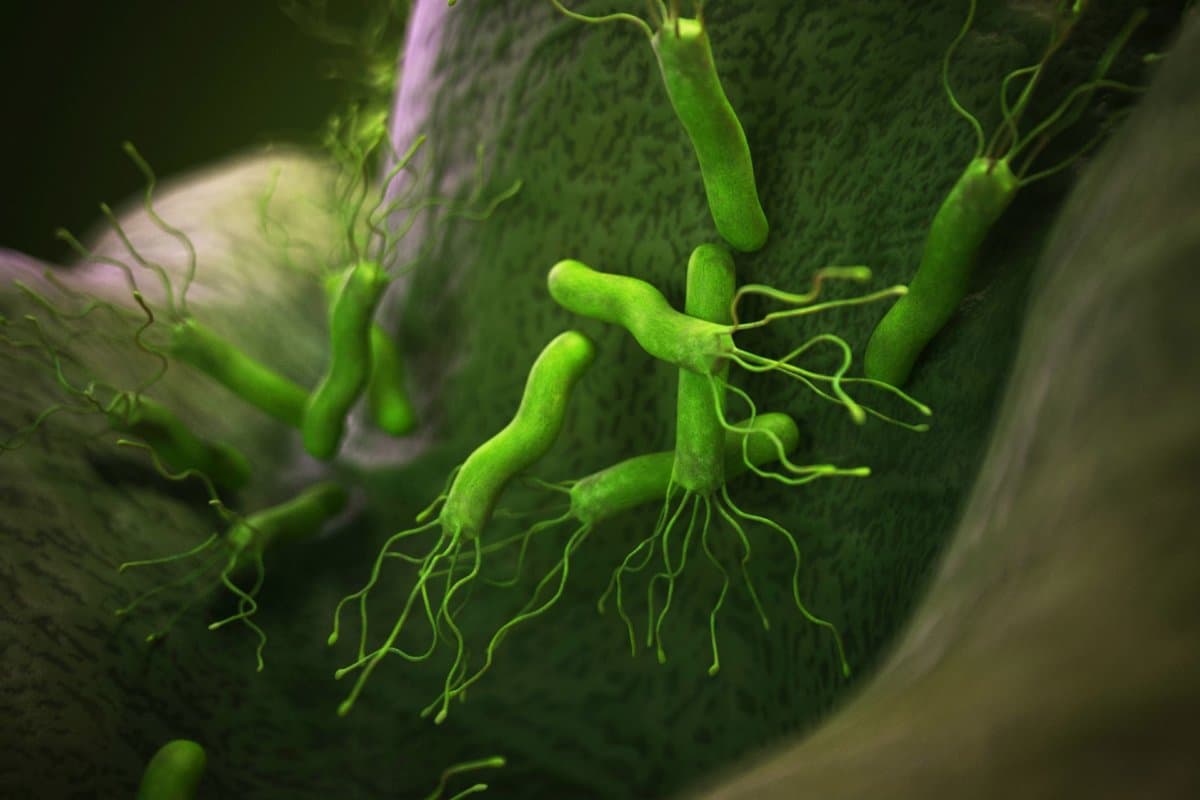 Eine Infektion mit H. pylori in Kombination mit bestimmten Risikogenen erhöhte das Magenkrebsrisiko stark.