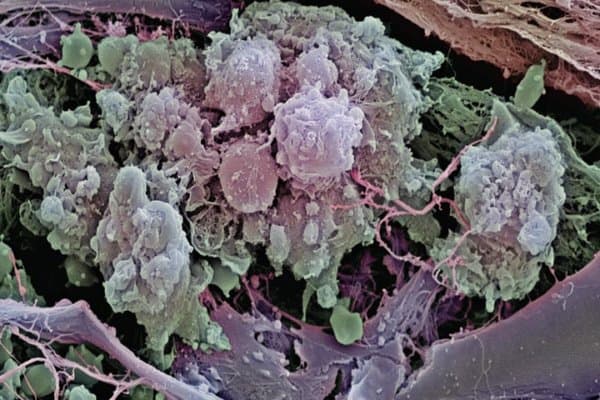 Trastuzumab richtet sich gegen HER2, das einige Krebszellen exprimieren. So erreicht auch der Wirkstoff die Zellen.