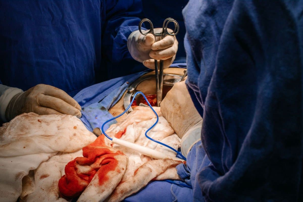 Hysterektomie, Tubenligatur und Ovarektomie sind mit erhöhtem Herz-Kreislauf-Risiko verbunden.