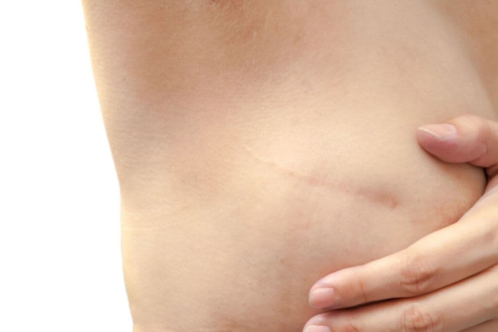 Nach einer Brustkrebs-Diagnose sollte die Therapie so schnell wie möglich beginnen.