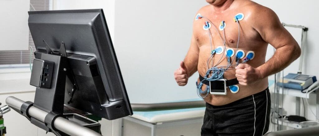 Schnitten Probanden auf dem Laufband besser ab, hatten sie später seltener Vorhofflimmern.