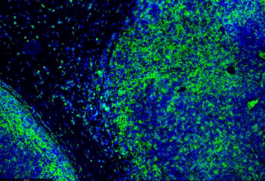 Eine Rechallenge mit Atezolizumab ging in der CONTACT-03-Studie ins Leere.
