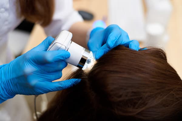 Microscopic examination of the hair and skin of the scalp.