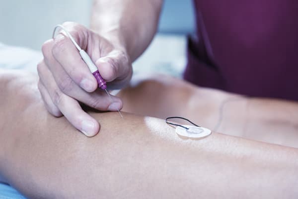 Bein eines Patienten, der vom Arzt mit Elektromyografie behandelt wird.