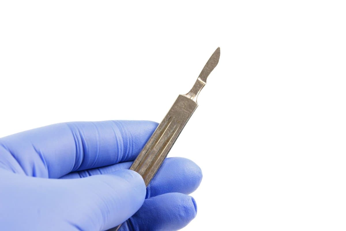 Ein neuer EORTC-Konsens bietet mehr Klarheit zu Resektionen im Stadium III.