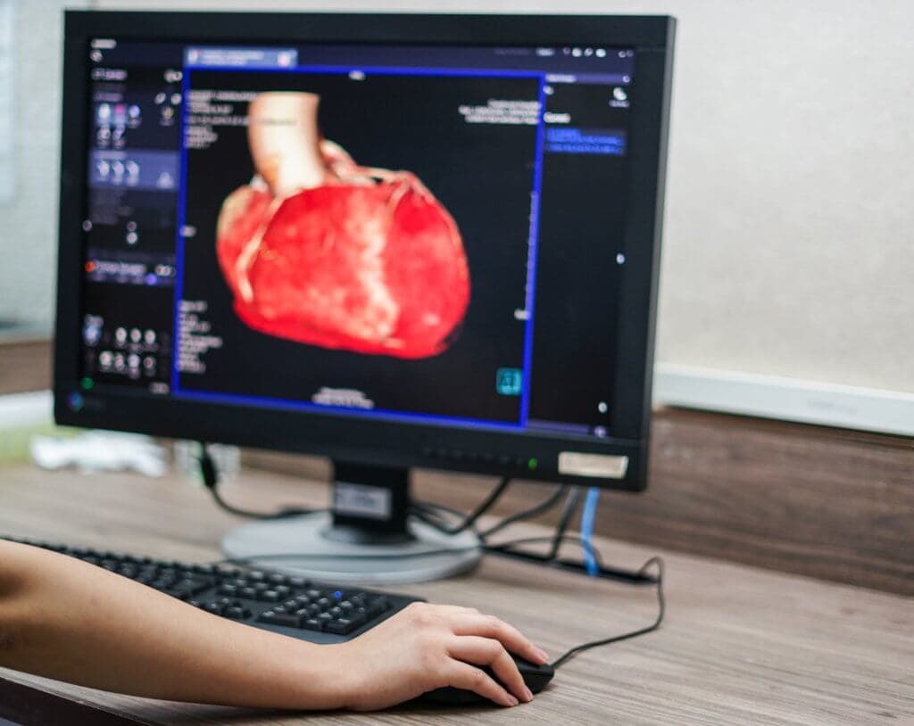 Errechnet sich eine niedrige Vortestwahrscheinlichkeit kann die invasive Diagnostik warten.