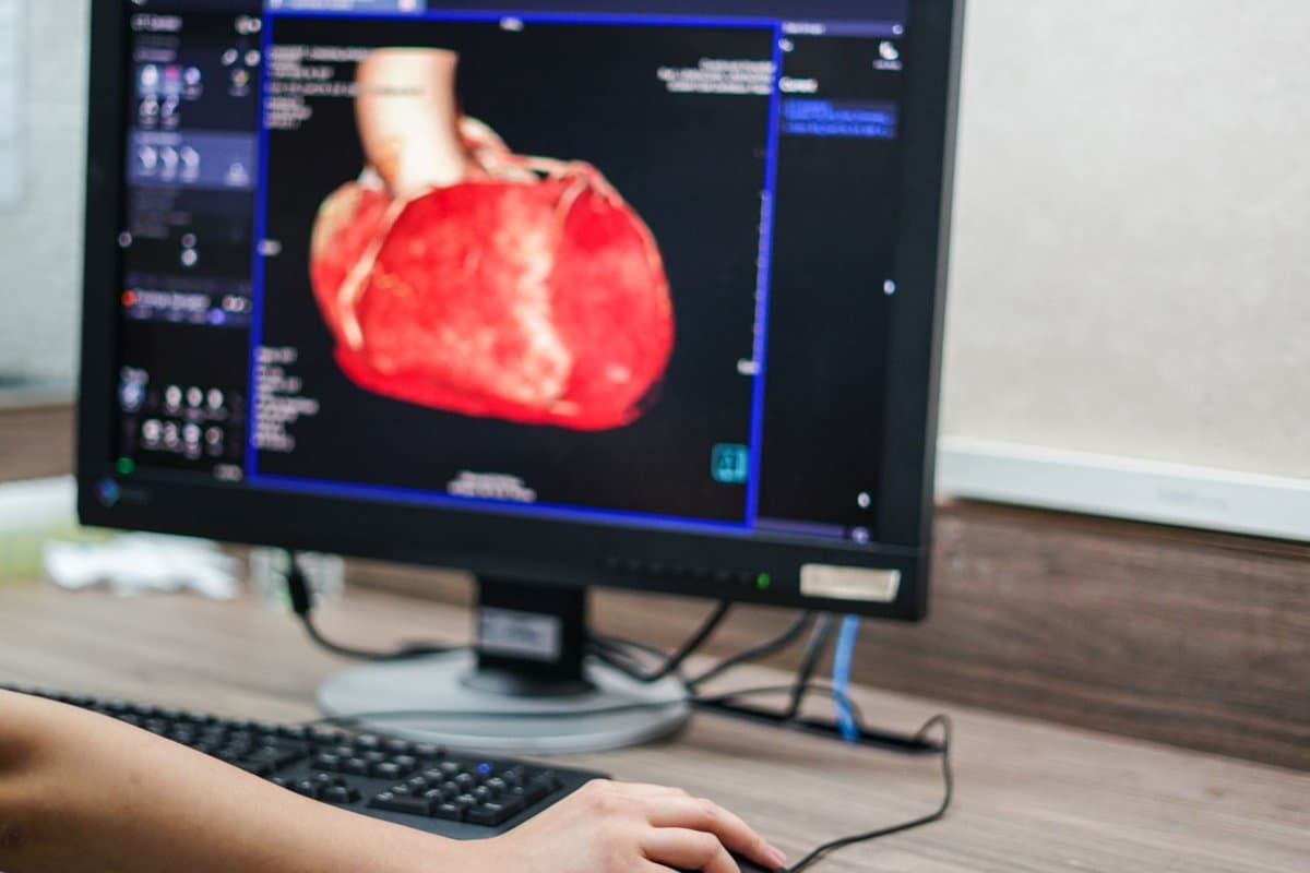 Errechnet sich eine niedrige Vortestwahrscheinlichkeit kann die invasive Diagnostik warten.