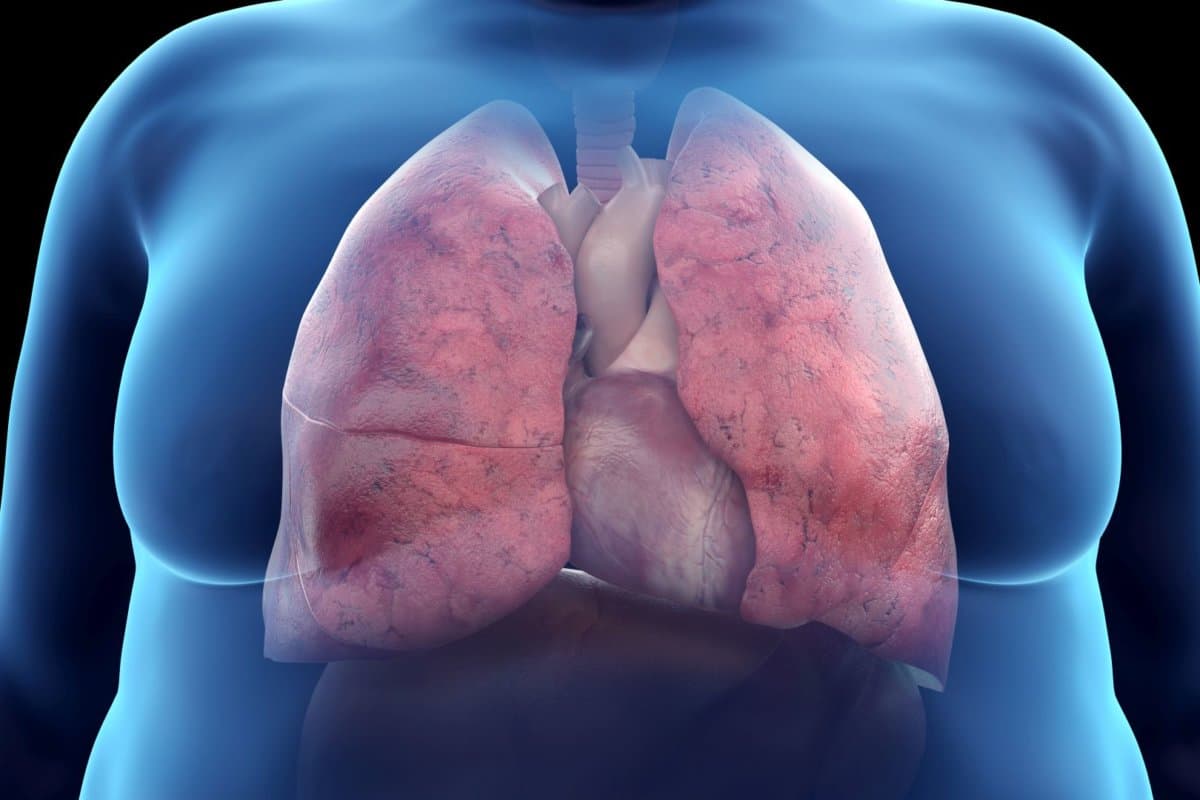 Behandelt man die COPD in Kontext mit anderen Komorbiditäten, ist das ein Gewinn für den Patienten und das Gesundheitssystem.