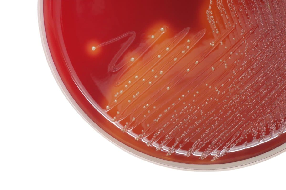 Verantwortlich für invasive Streptokokken-Infektionen (iGAS) ist der Keim Streptococcus pyogenes.