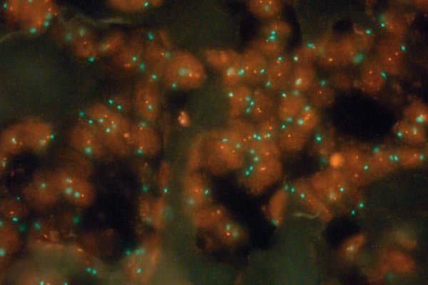 Fluoreszenz-in-situ-Hybridisierung, kurz FISH
