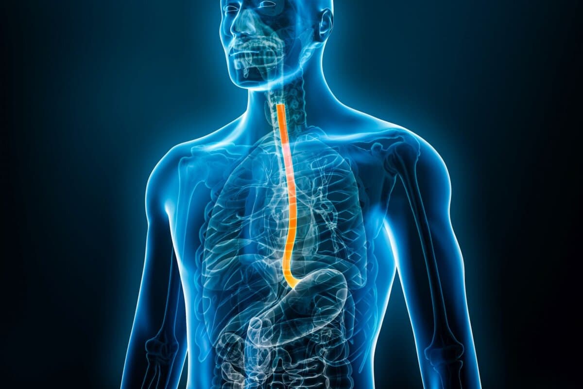 Ob Eosinophile bei einer Ösophagitis vorhanden sind, ist nicht allein ausschlaggebend für die Diagnose.