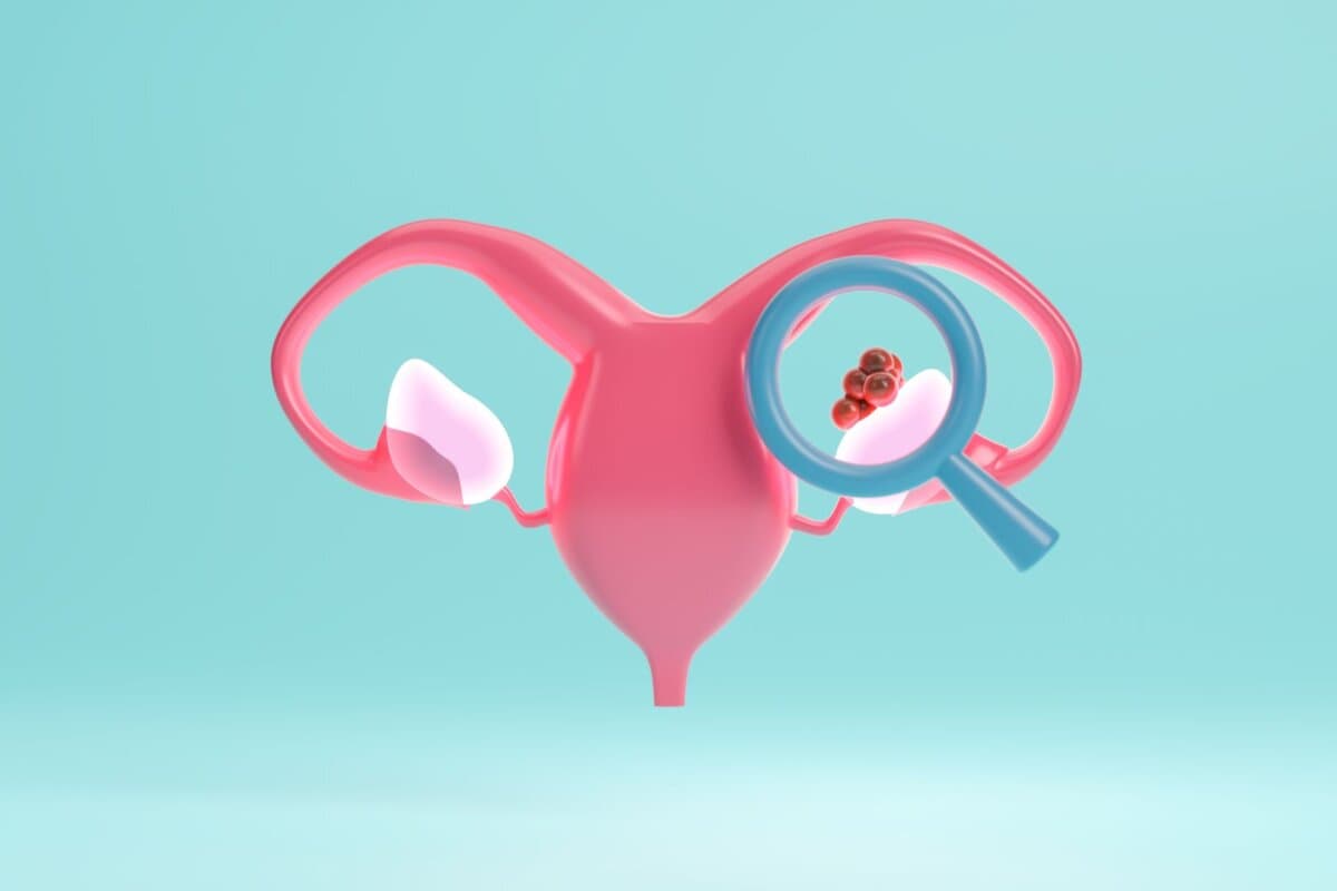 Ovarialkarzinome mit BRCA-Mutationen haben eine höhere Chemosensitivität.