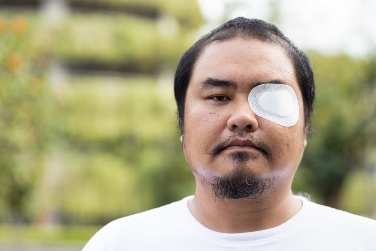 Bei der NAION kommt es zu einem plötzlichen Visusverlust auf einem Auge.