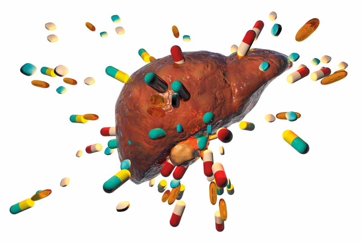 Drug-induced hepatotoxicity, illustration