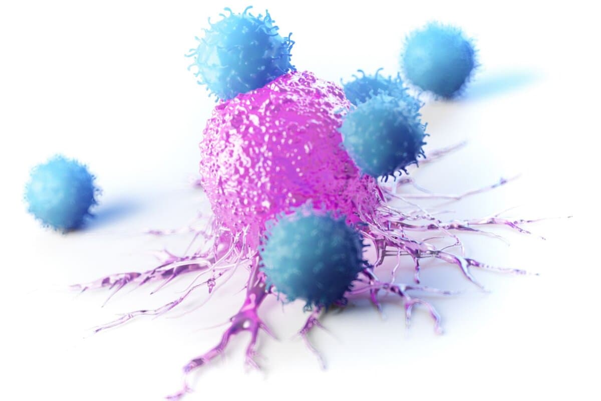 Die neoadjuvante Immuntherapie bewährt sich beim Melanom.