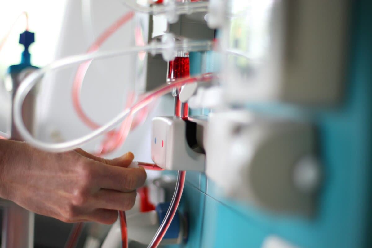 Eine dialysepflichtige Nierenerkrankung im Zusammenhang mit Diabetes erhöht das Krebsrisiko noch nicht.