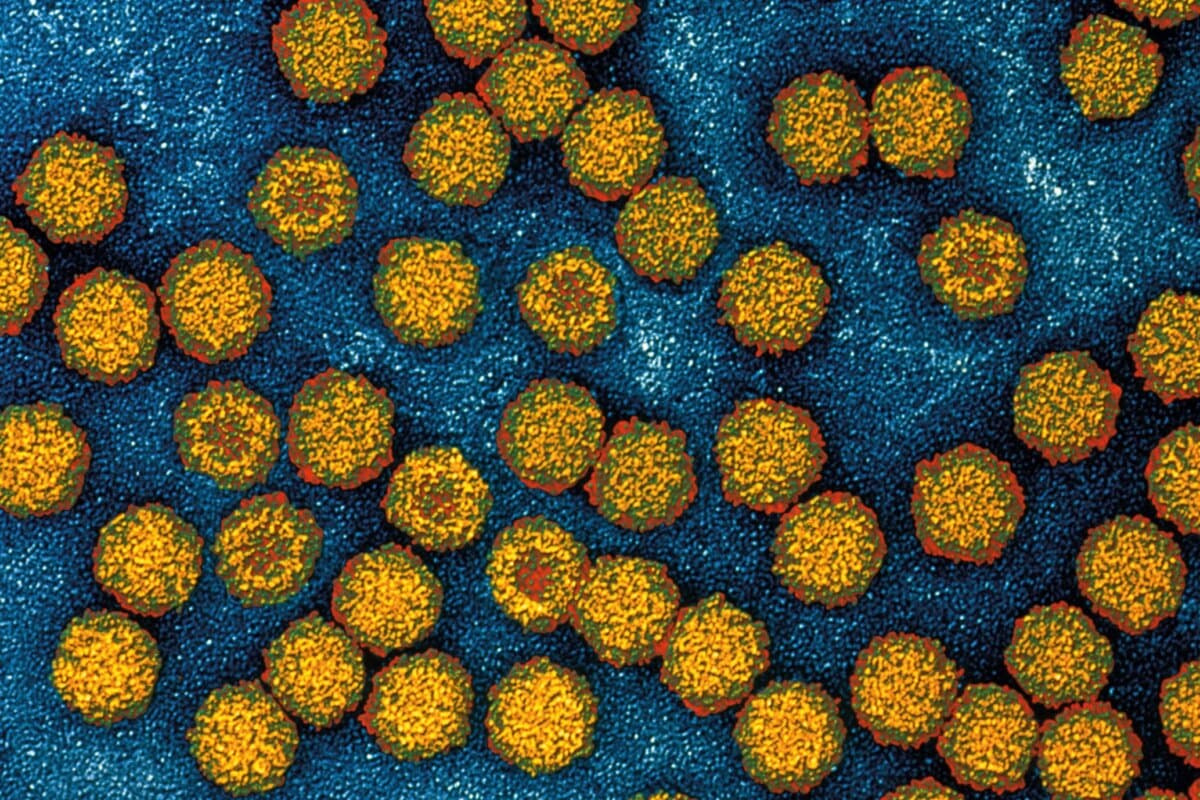 Une infection au parvovirus B19 peut également entraîner des modifications de la formule sanguine.