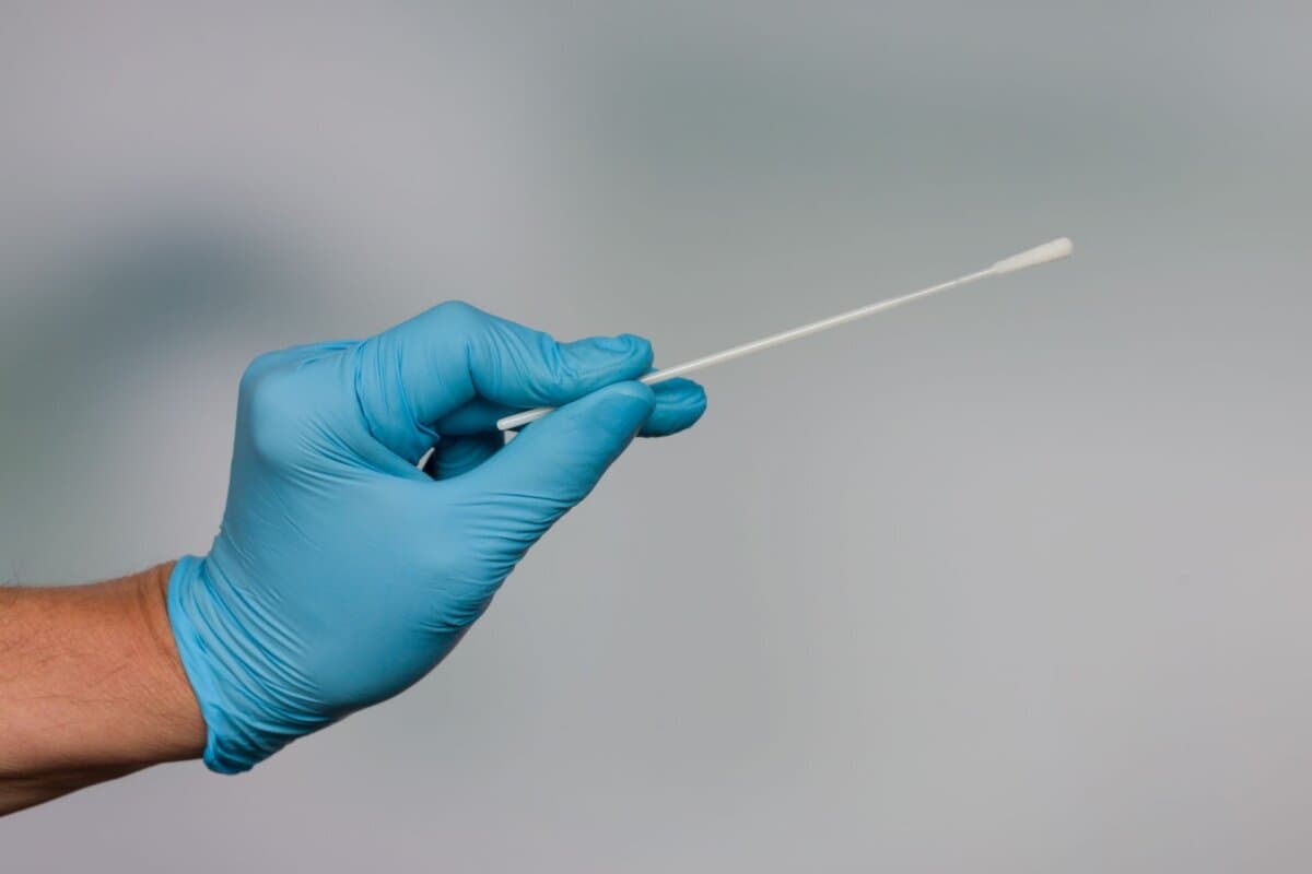 Zur Blockade des Ganglion sphenopalatinum bei Patienten mit Migräne gibt es mehrere Methoden.