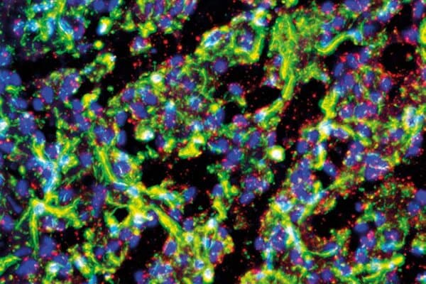 Image de cellules au microscope à fluorescence