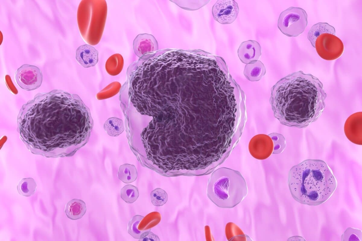 Moderne Therapien haben die Stammzelltransplantation beim Lymphom zunehmend entthront.
