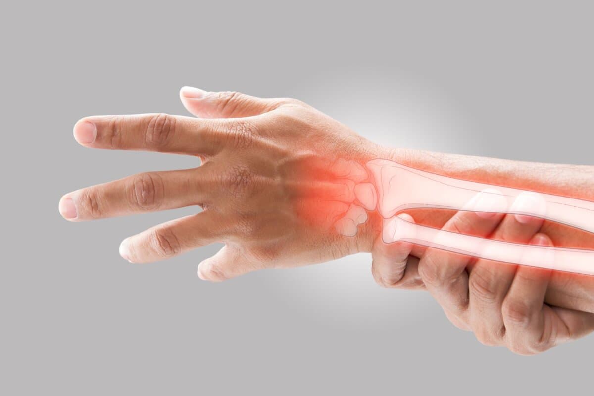 Rheumatische Erkrankungen begünstigen auch die Entstehung von Osteoporose.