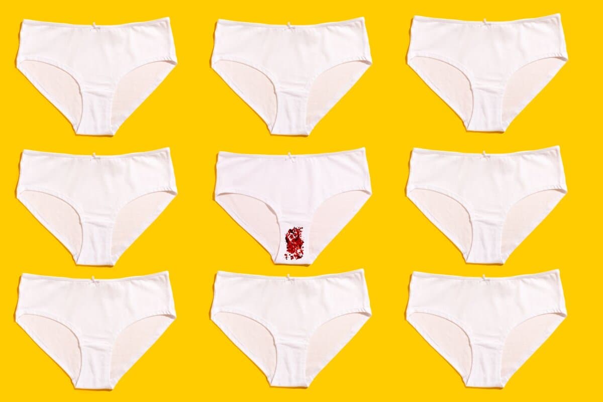 Unter dem Überbegriff "abnorme uterine Blutung" werden mehrere Blutungsstörungen zusammengefasst.