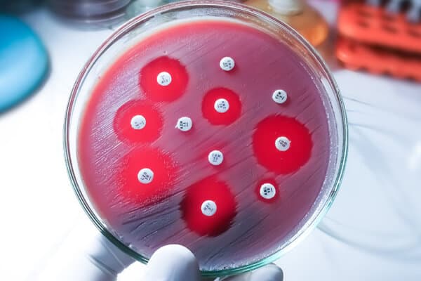 Test de sensibilité aux antimicrobiens en boîte de Petri.
