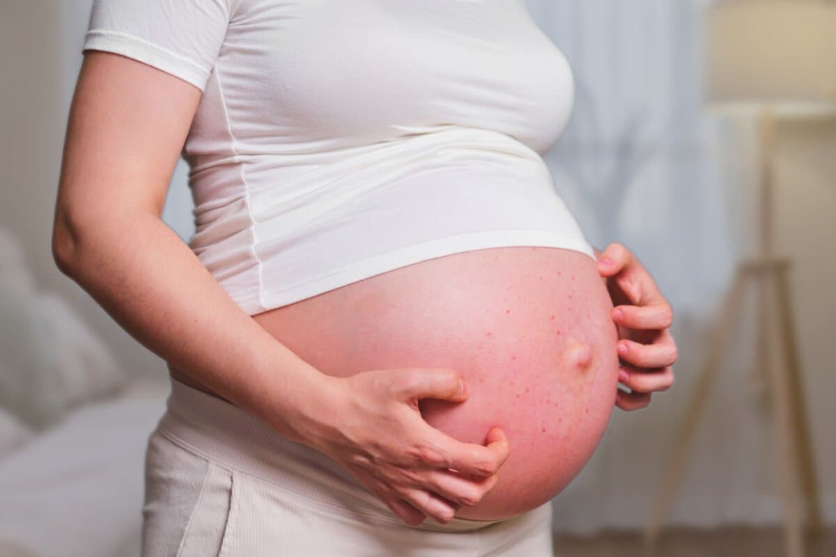 Plusieurs atteintes cutanées peuvent se manifester pour la première fois pendant la grossesse.