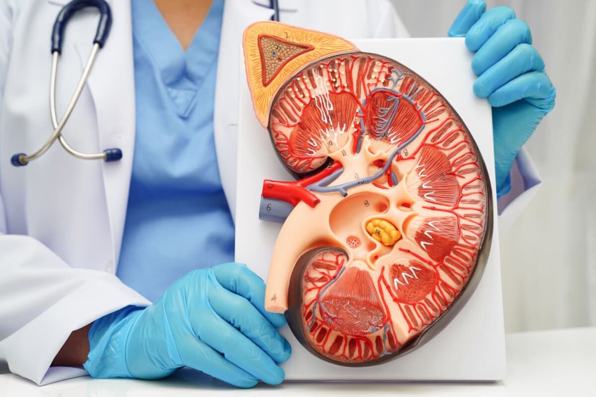 Psoriasisarthritis begünstigt die chronische Nierenerkrankung.