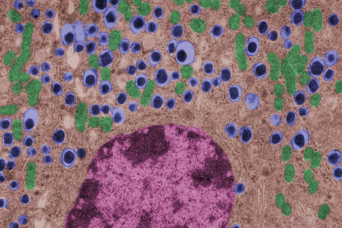 Une nouvelle étude n’a identifié aucun antidiabétique capable de freiner la perte des cellules bêta.