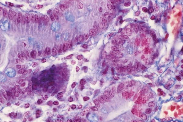 Image au microscope optique de la muqueuse de l'intestin grêle