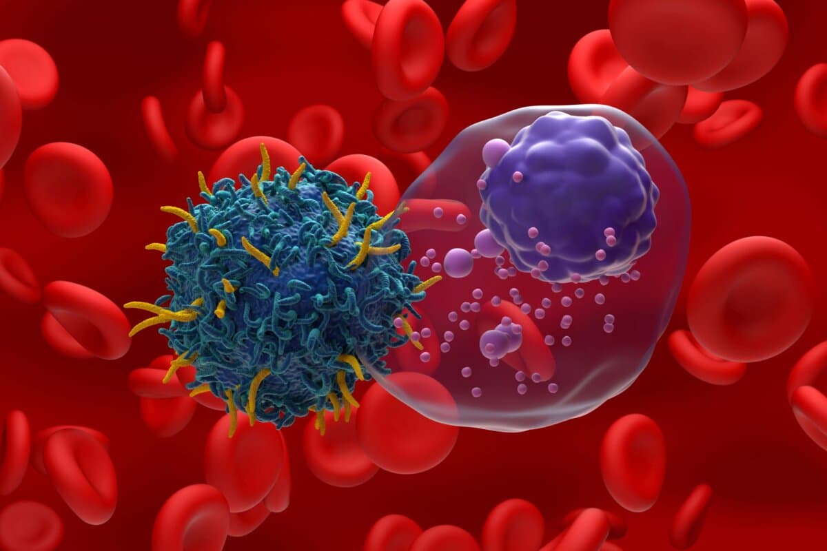 Vier Jahre nach CAR-T-Zell-Therapie entwickeln 10 % der Patienten myeloide Neoplasien.
