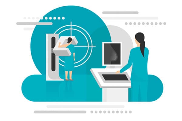 Schematische Abbildung einer Mammografie.