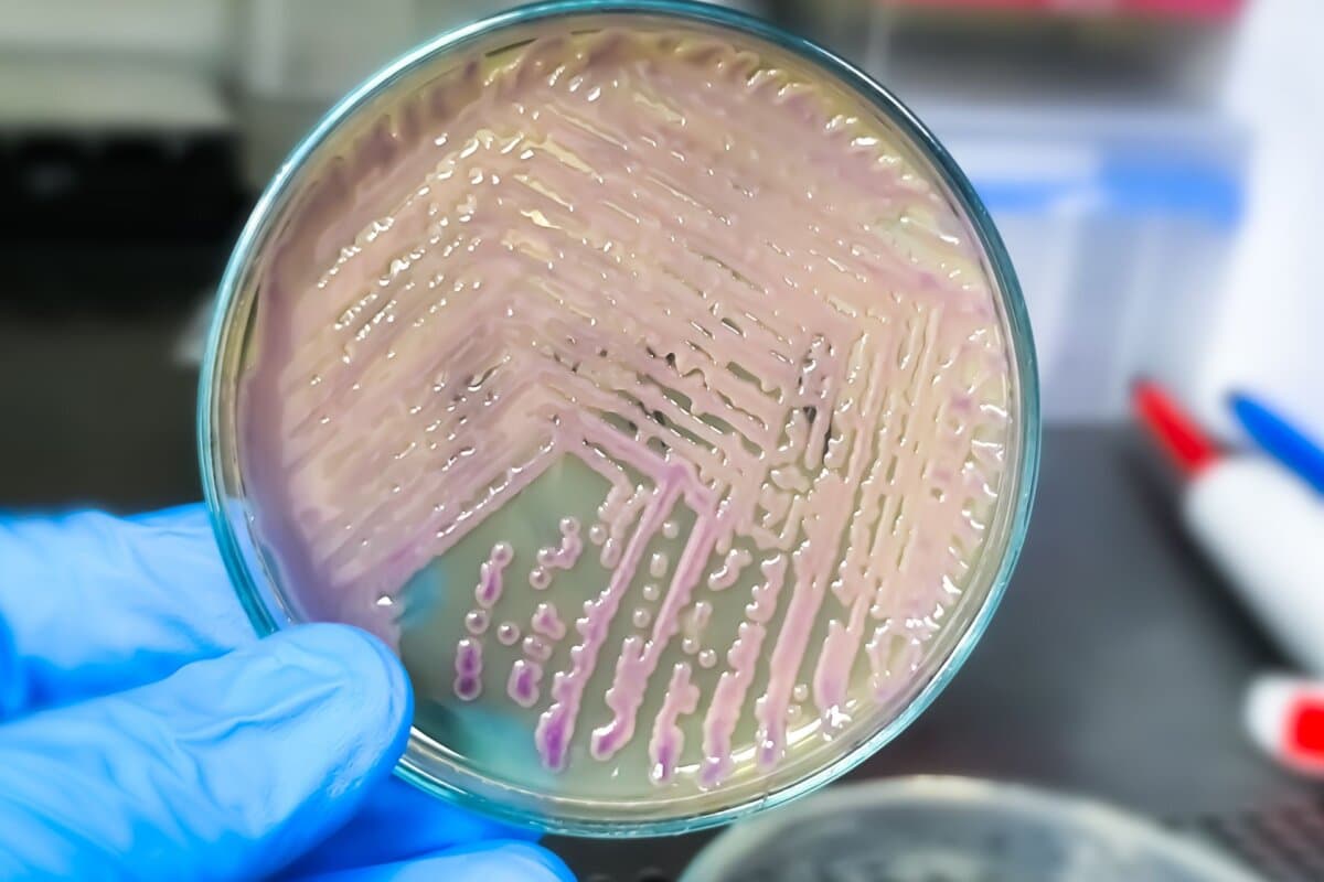 Uropathogene E coli sind die häufigsten Auslöser eines Harnwegsinfektes.