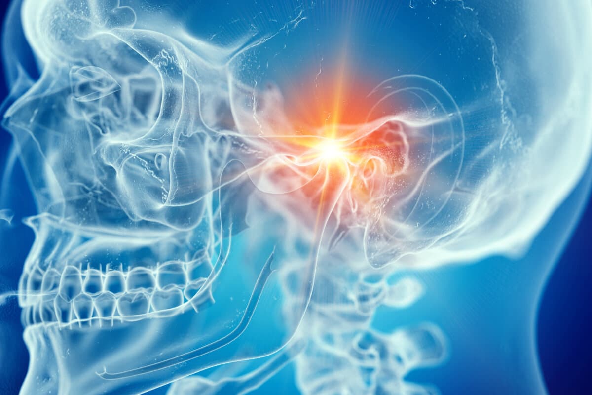 Illustration médicalement précise en 3D d'une articulation temporo-mandibulaire douloureuse