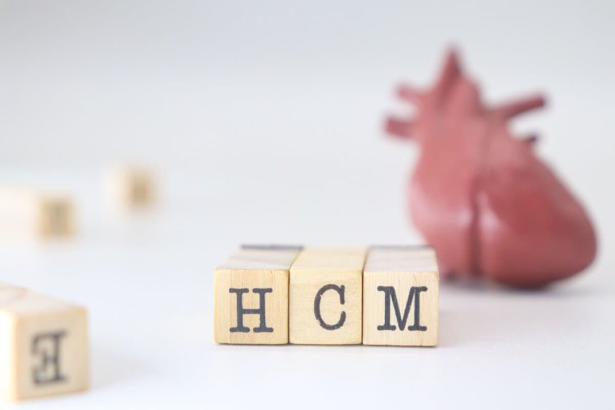 Zu den neuen Management-Konzepten für Patienten mit hypertopher obstruktiver Kardiomyopathie gehört ein Myosin-Inhibitor.