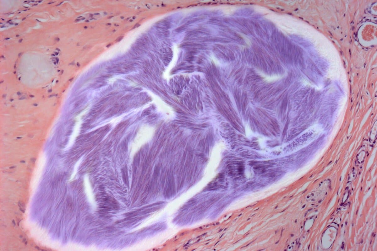 Micrographie optique de la goutte