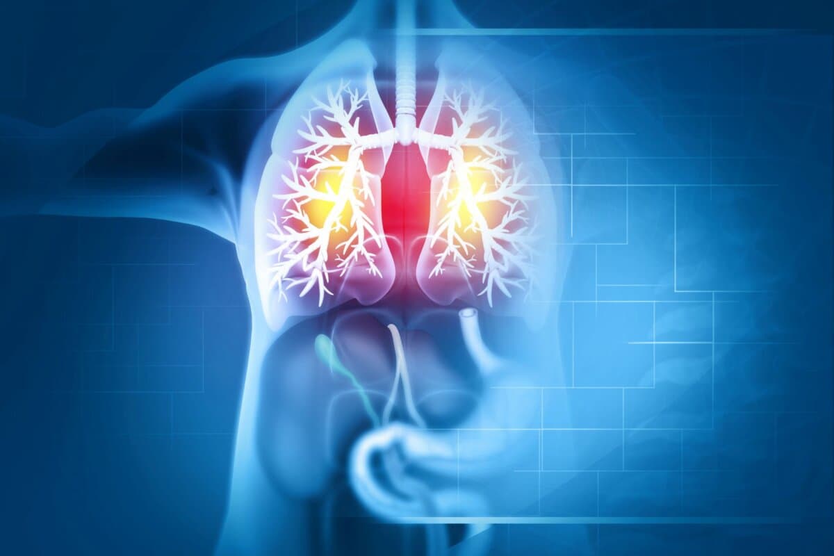 Les pneumoathies interstitielles diffuses restent un défi diagnostique.