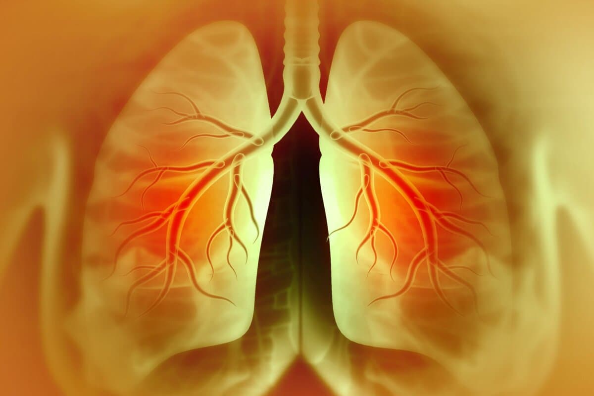 Chronic obstructive pulmonary disease, respiratory diseases, 3d illustration