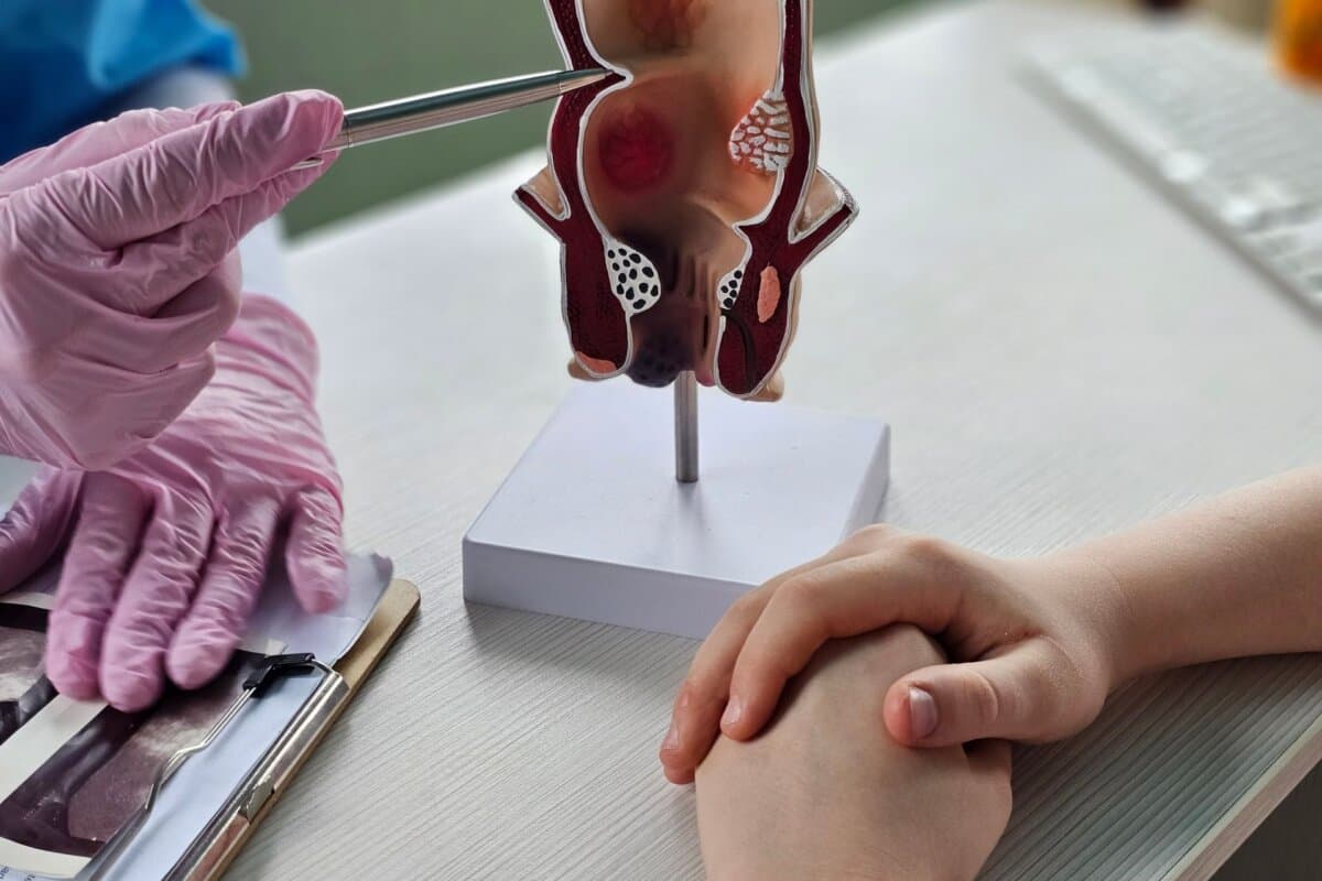 Ein Proktologe erläutert rektale Pathologien anhand eines anatomischen Modells.