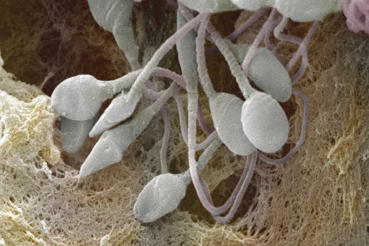 Rasterelektronenmikroskopische Aufnahme (SEM) menschlicher Spermien (Spermatozoen).